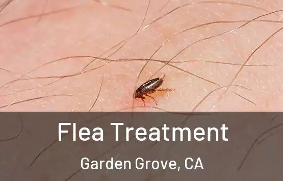  Flea Treatment Garden Grove, CA